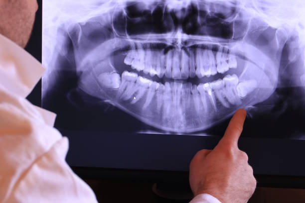 Best Emergency Broken Tooth Repair in South Pekin, IL